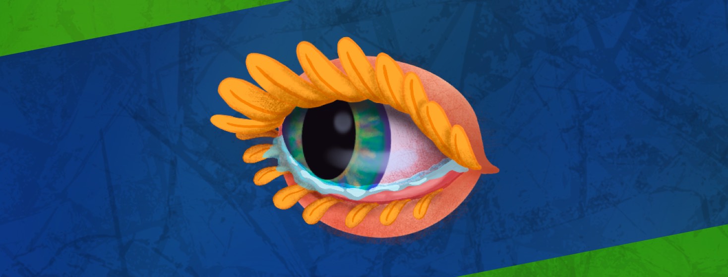 A Closer Look at Eye Issues and Allergies image