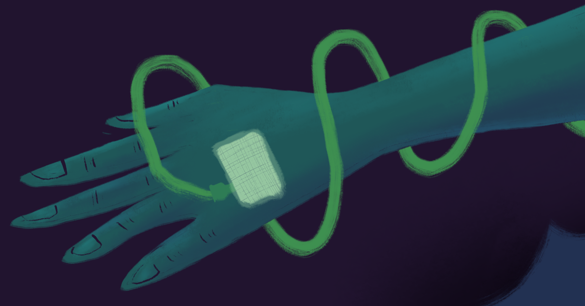 Adverse Reactions to IV Iron Infusions Rare but Serious